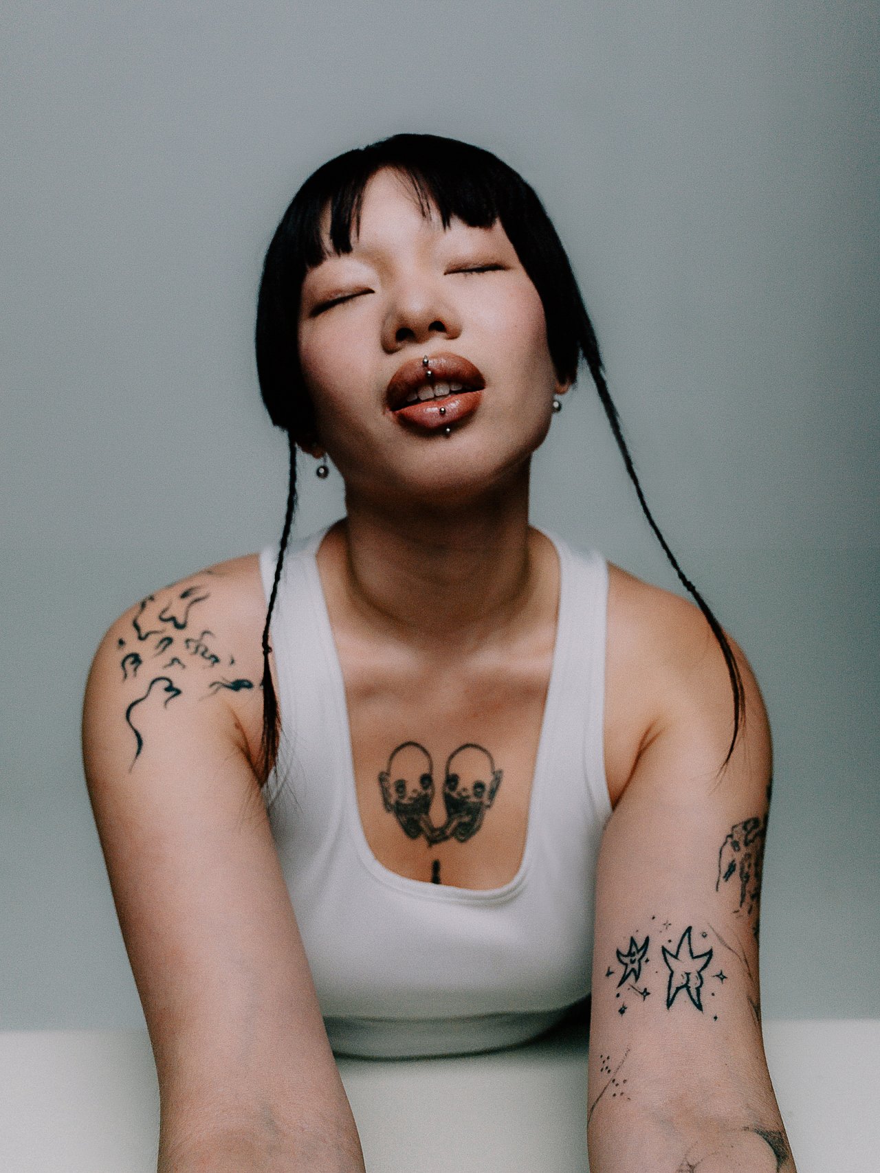 EM-A filtered image 10