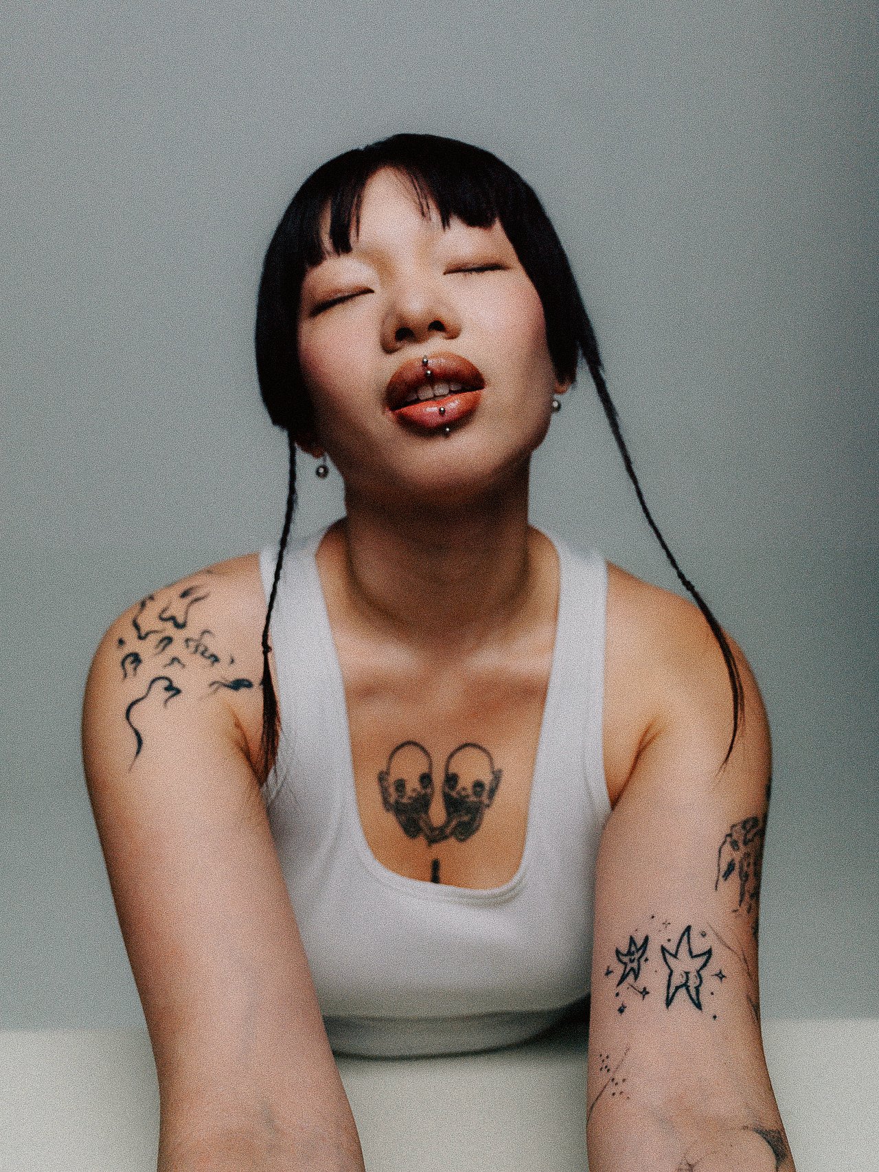 EM-A filtered image 1