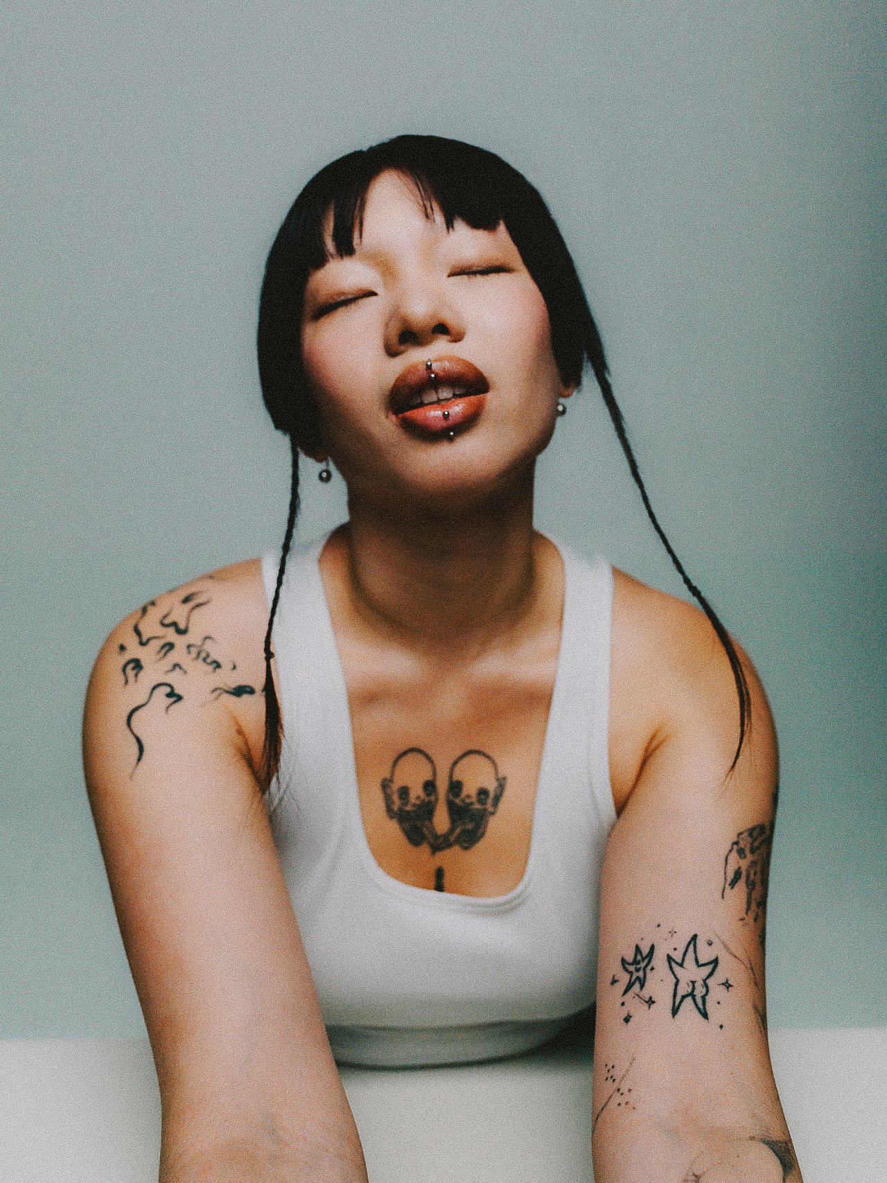 EM-A filtered image 25