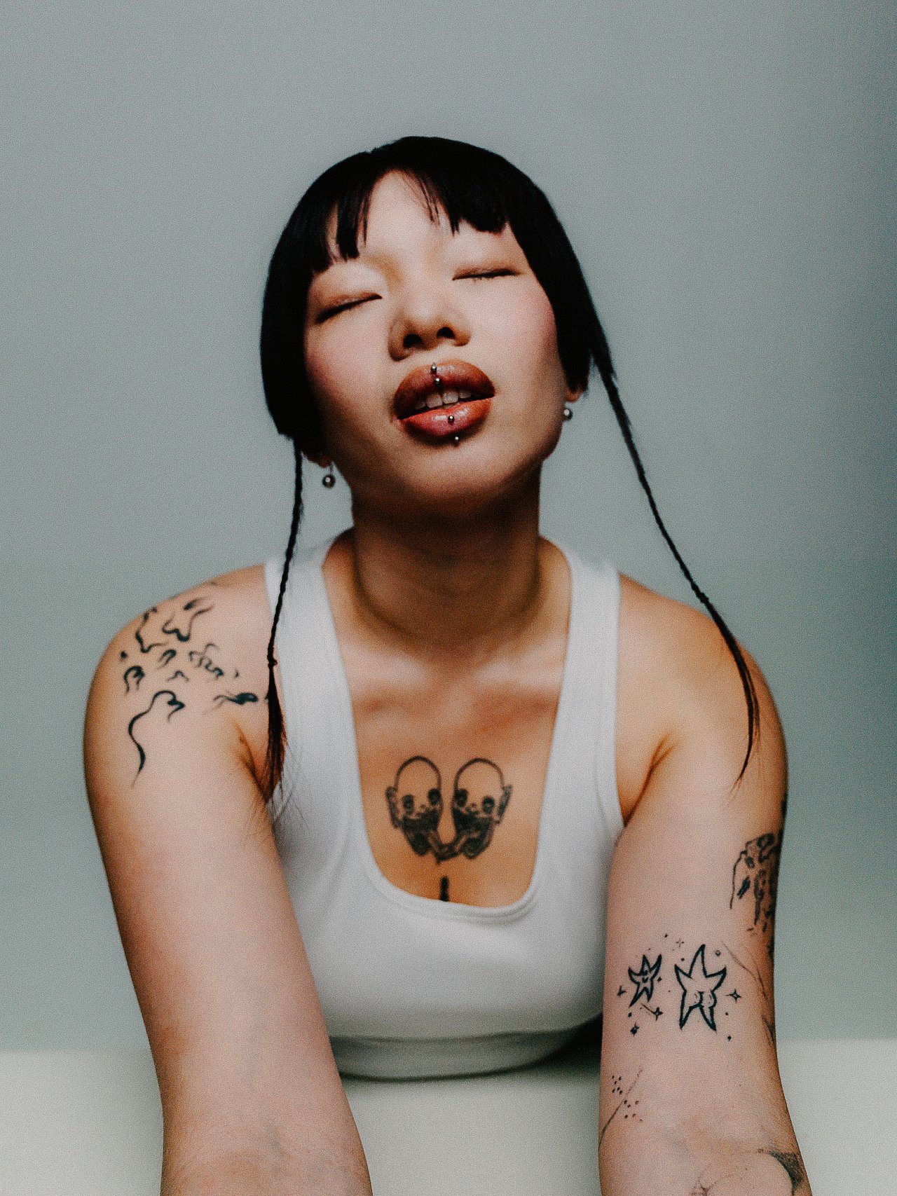 EM-A filtered image 2