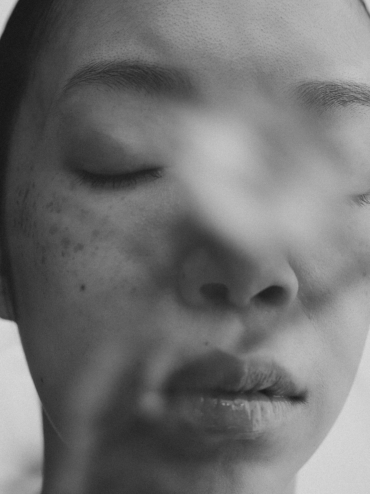 EM-B filtered image 2