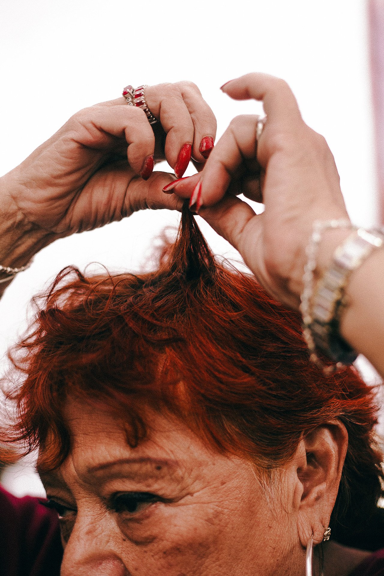 EM-I filtered image 2