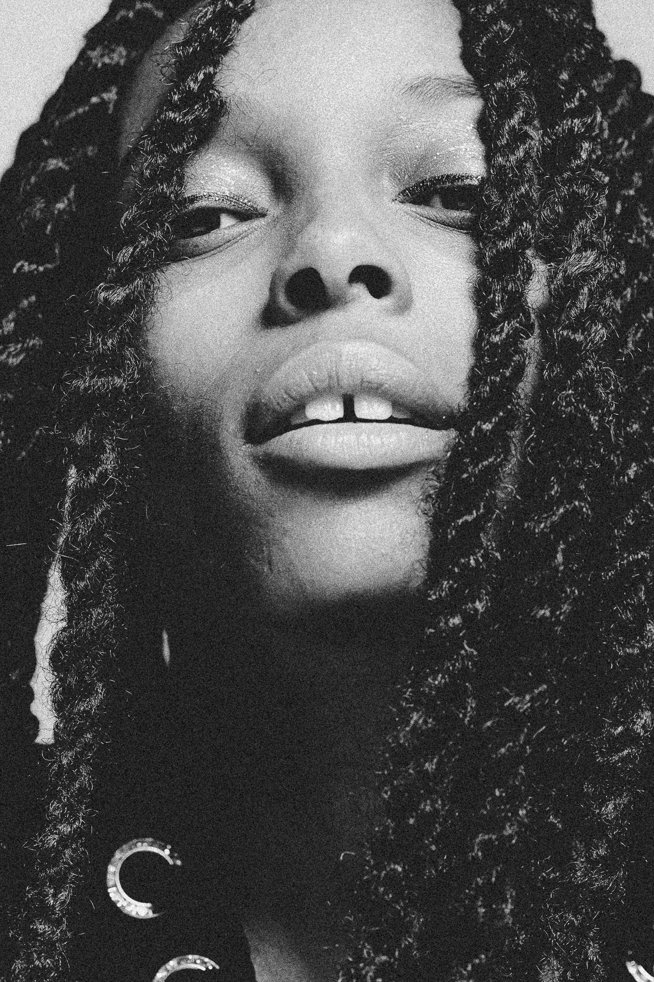 EM-L filtered image 10