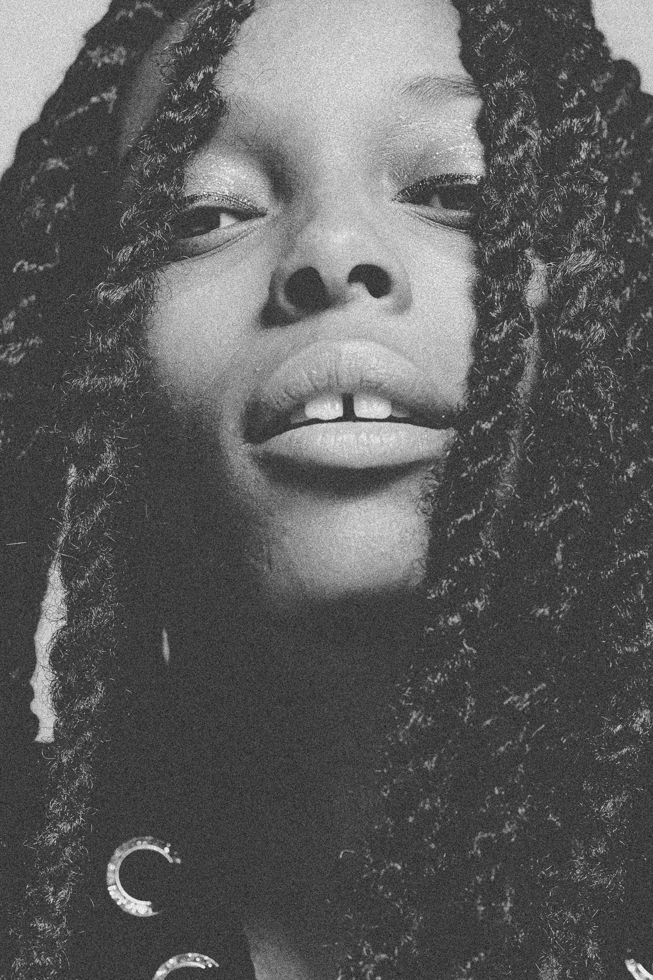 EM-L filtered image 12