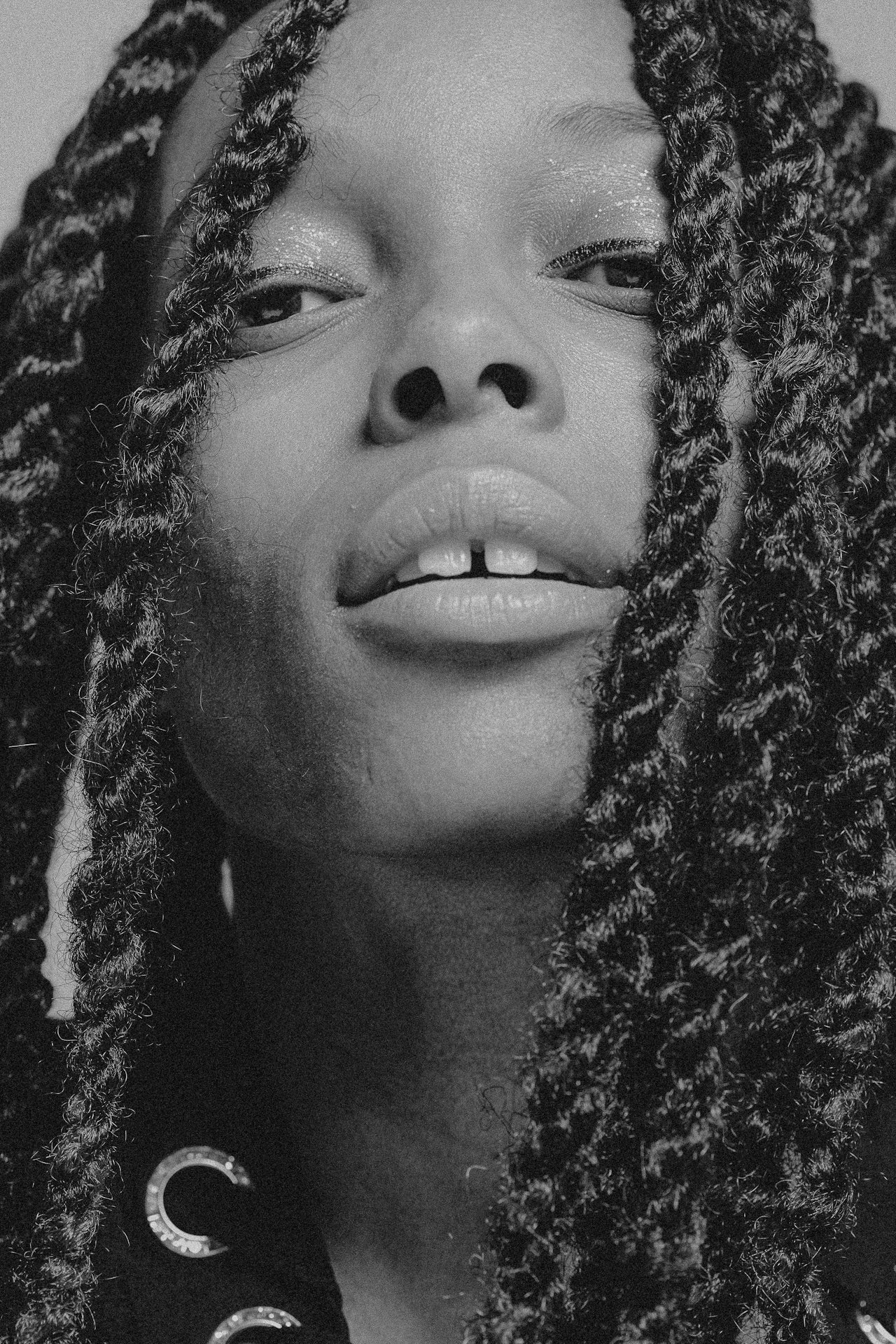 EM-L filtered image 13