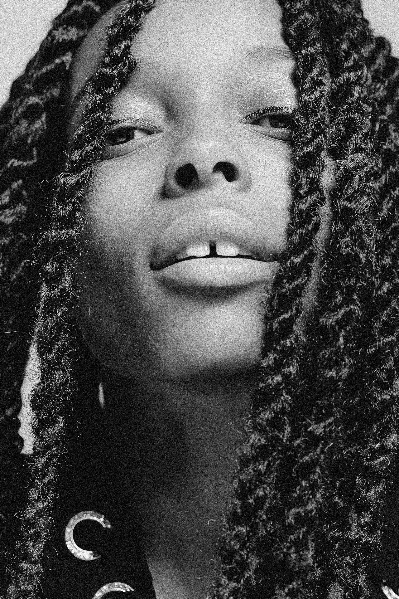 EM-L filtered image 19