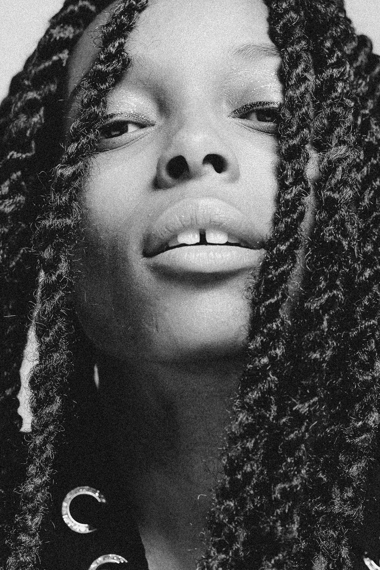 EM-L filtered image 20