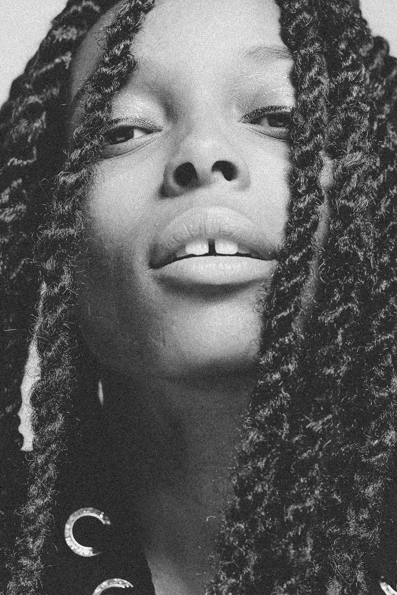 EM-L filtered image 22