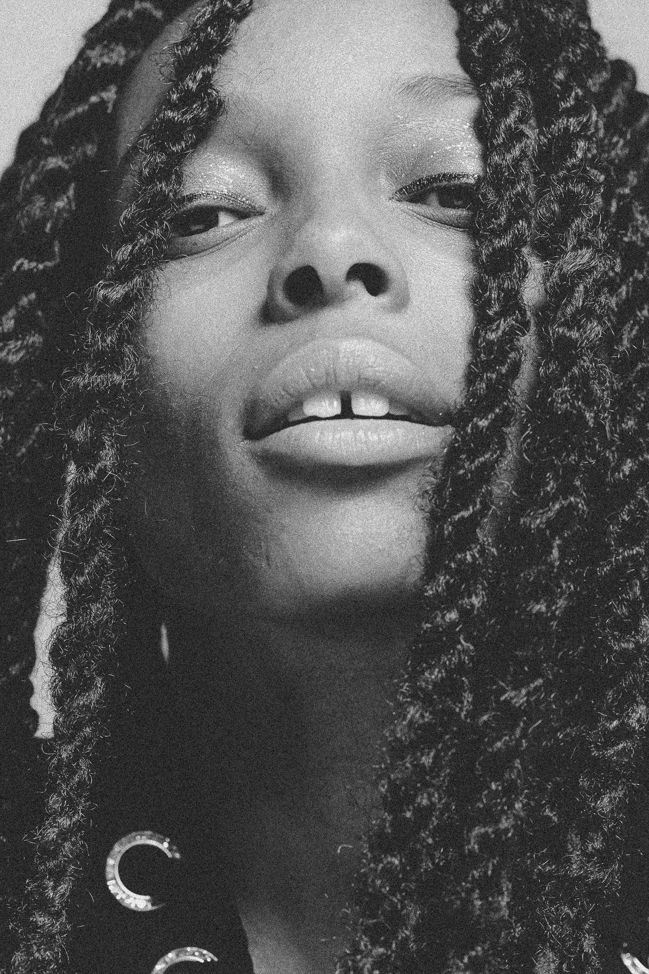 EM-L filtered image 3