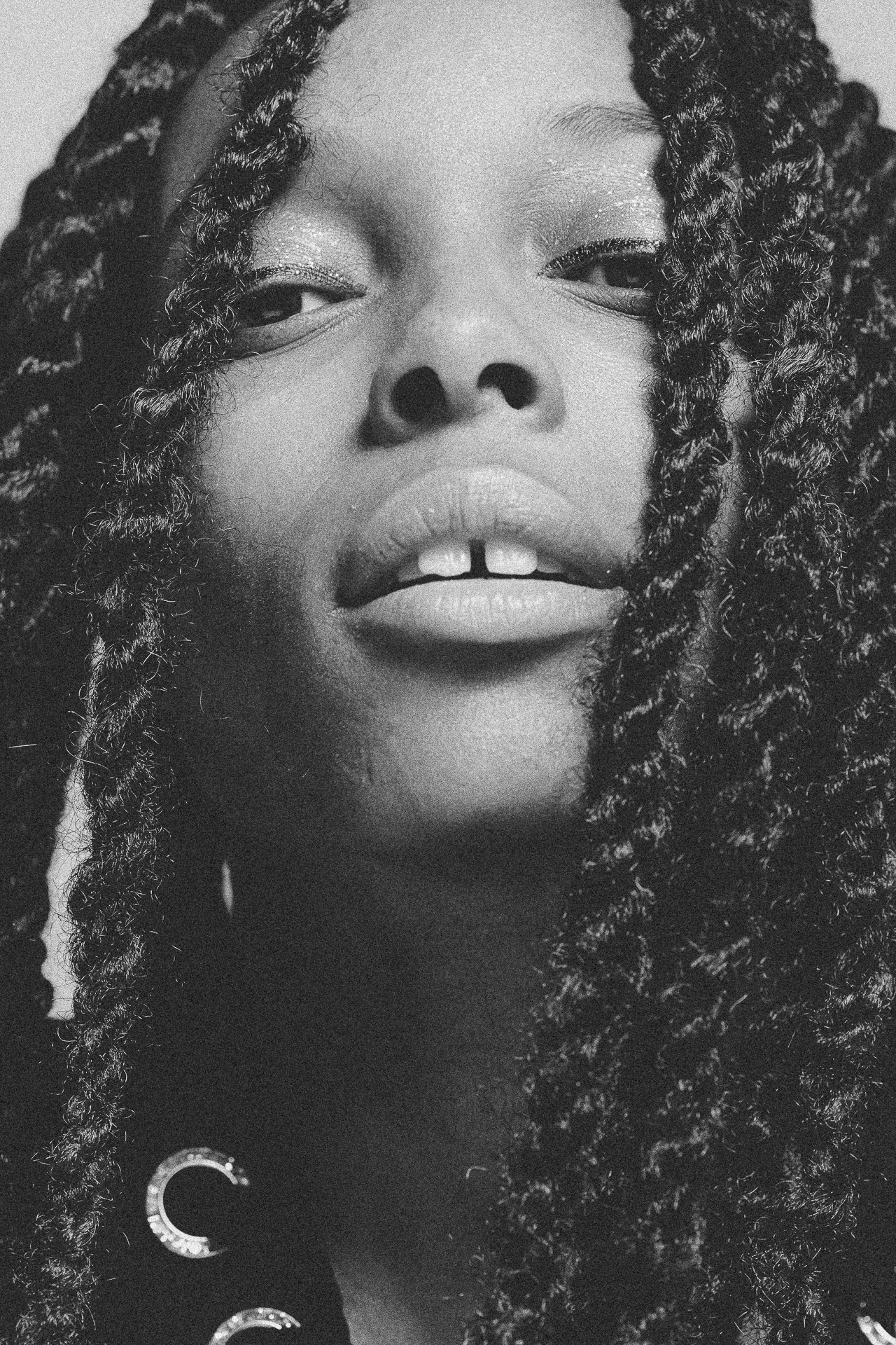 EM-L filtered image 7