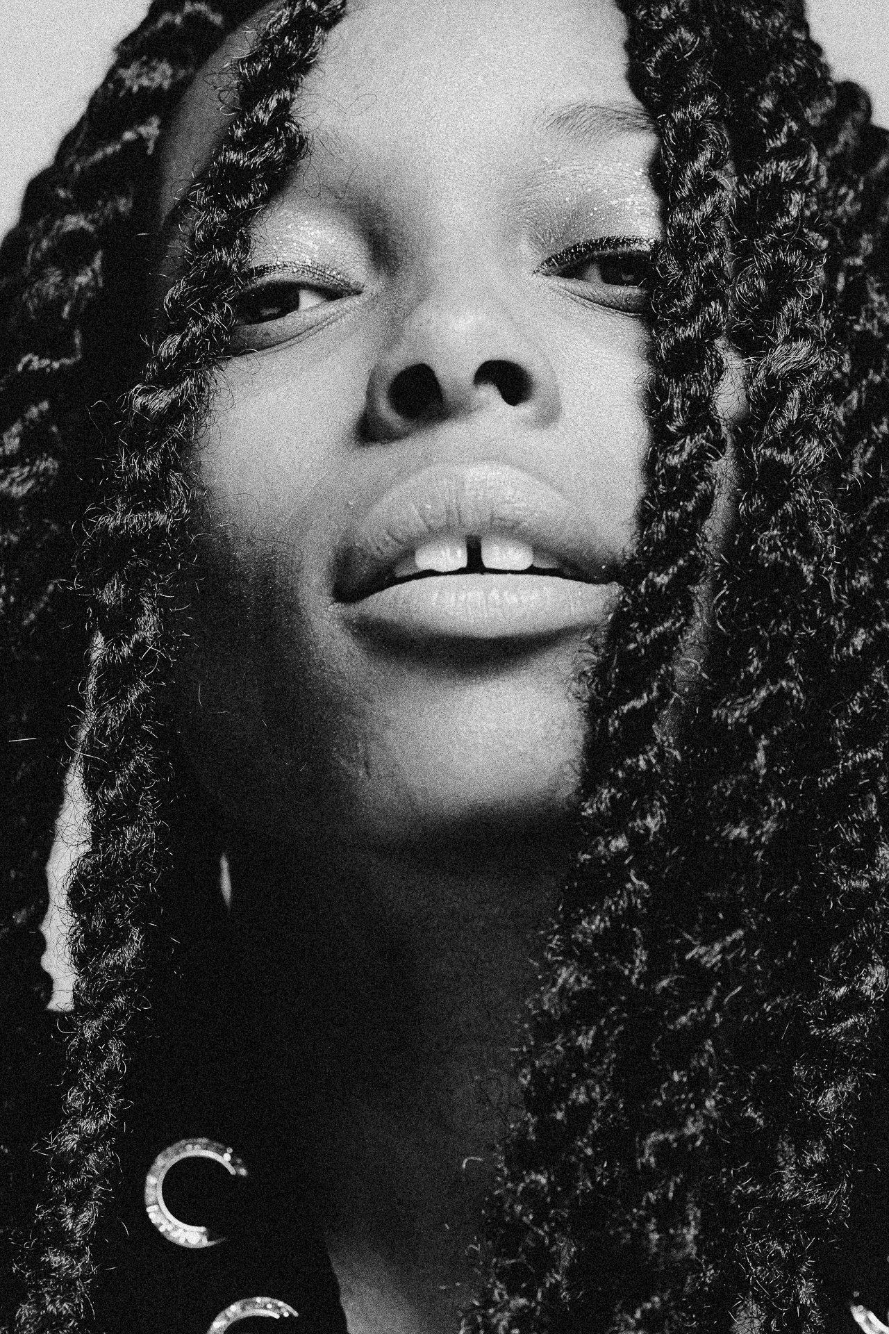 EM-L filtered image 8