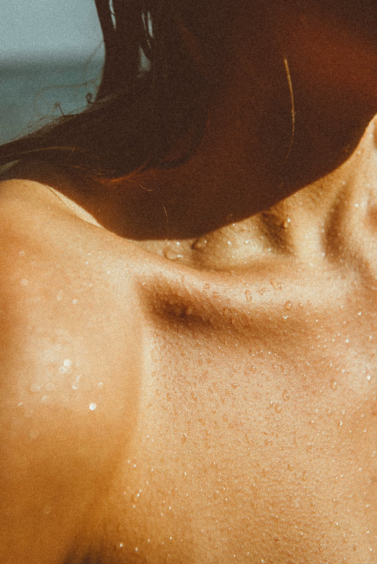 EM-U filtered image 32