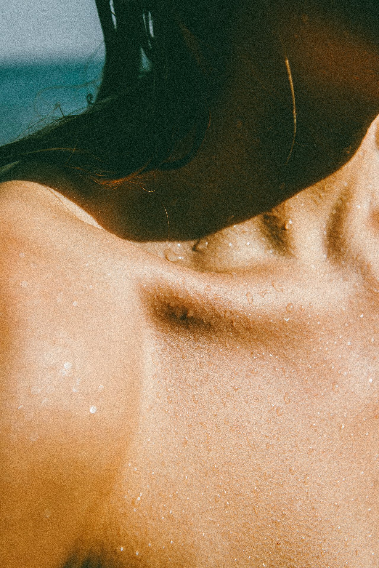 EM-U filtered image 3