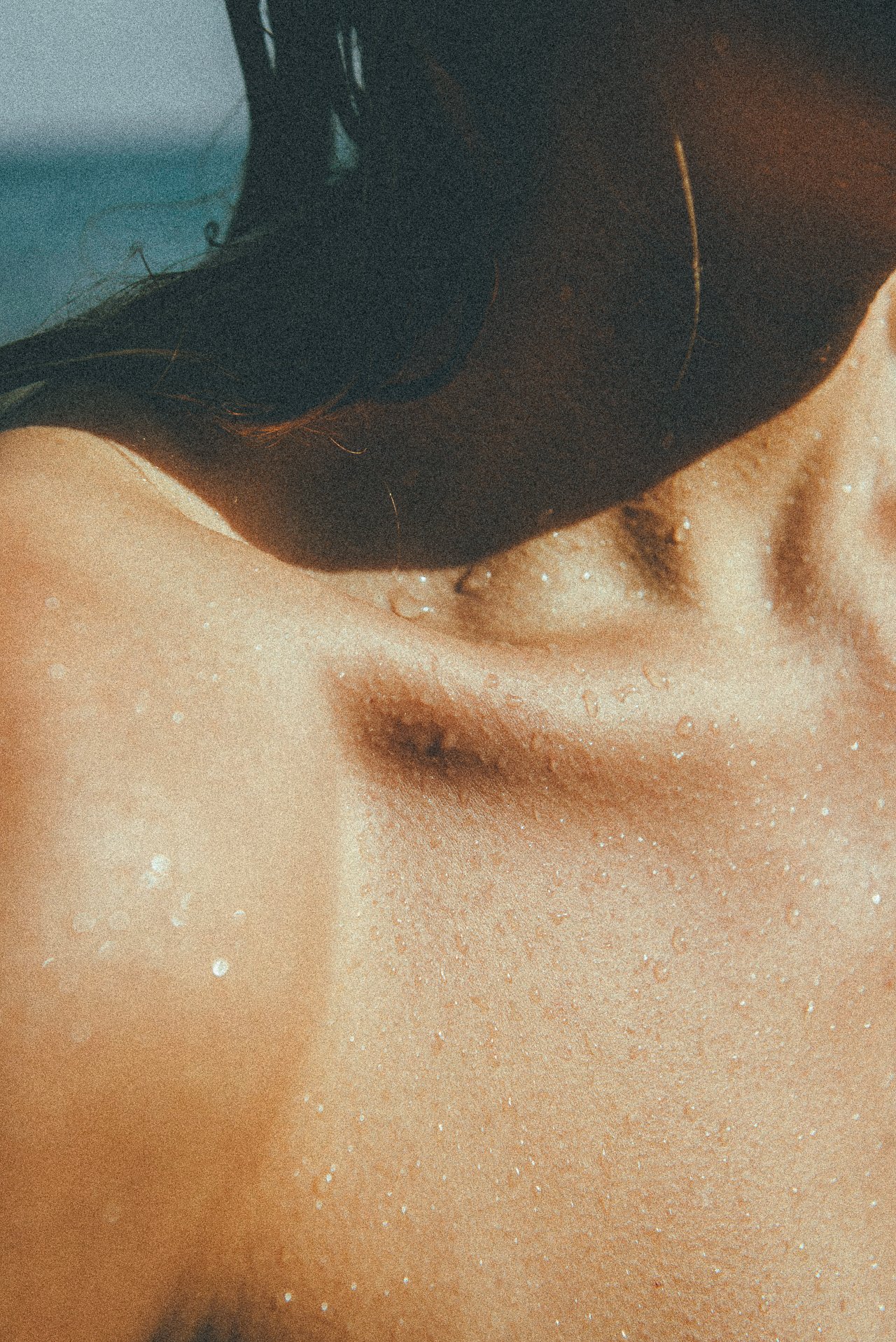 EM-U filtered image 7